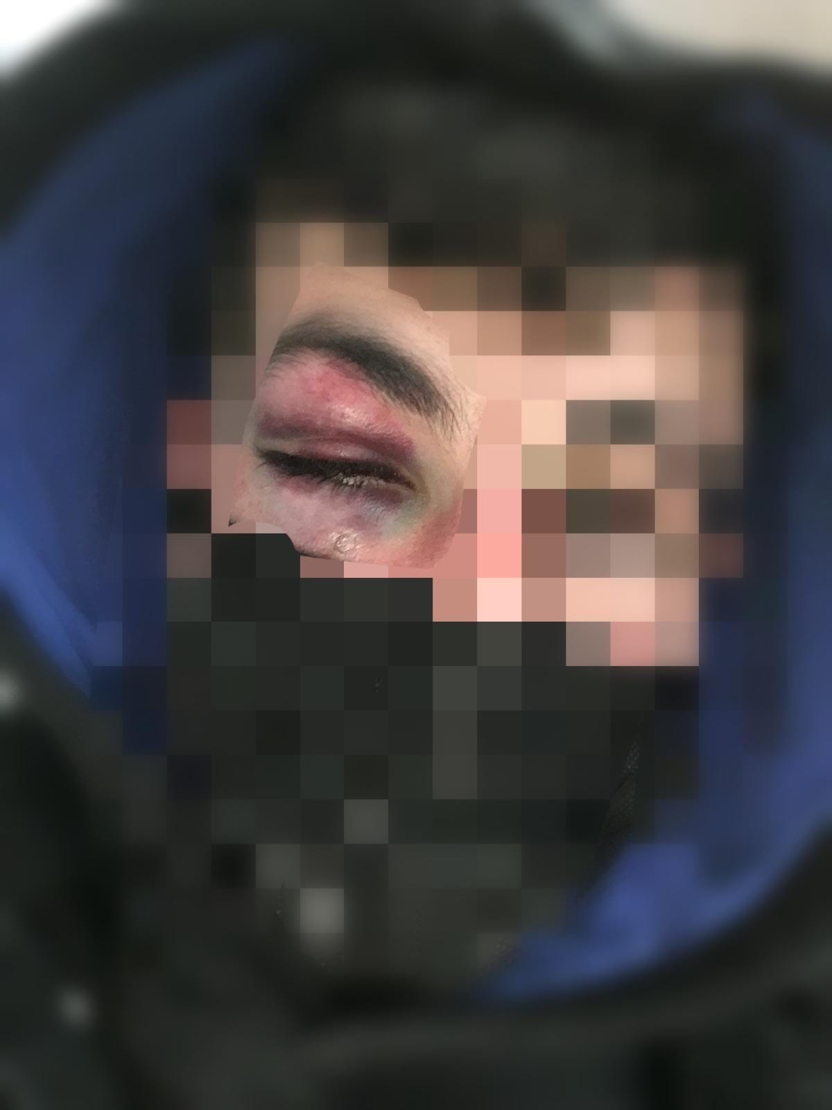 יהודי הותקף באכזריות במרכז העיר