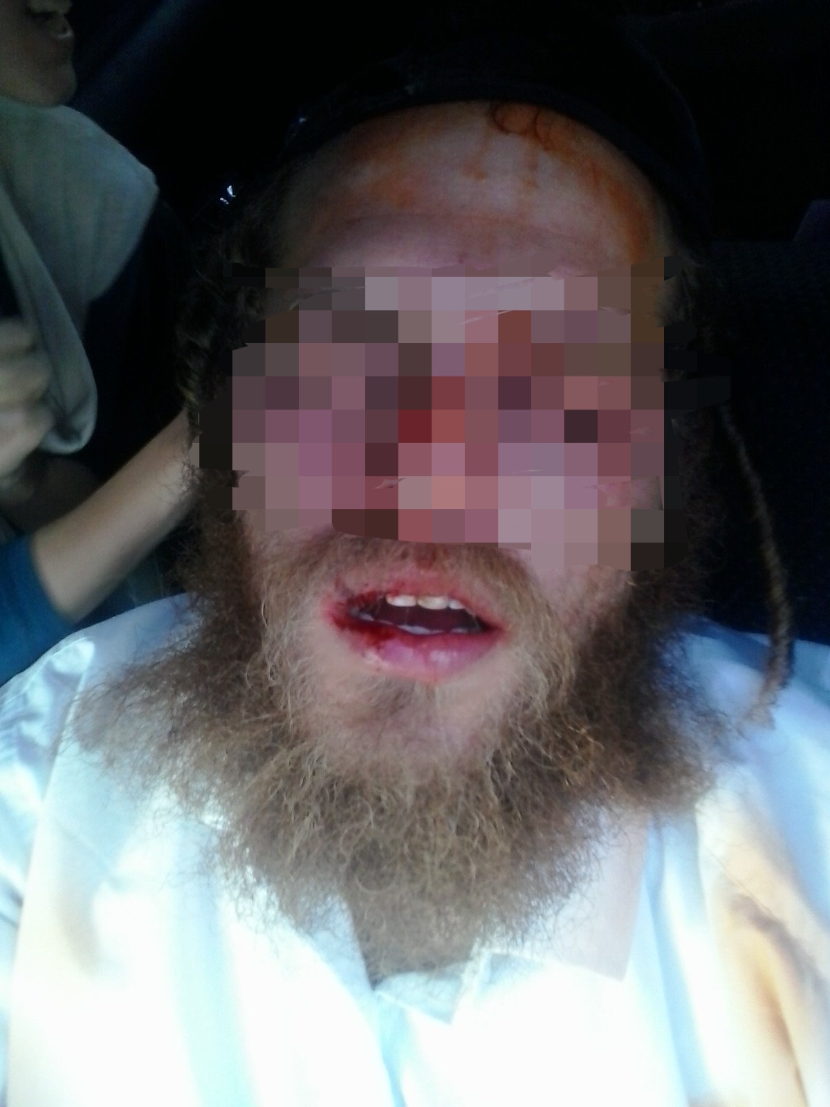 שבועיים אחרי הלינץ: אין חשודים במעשה