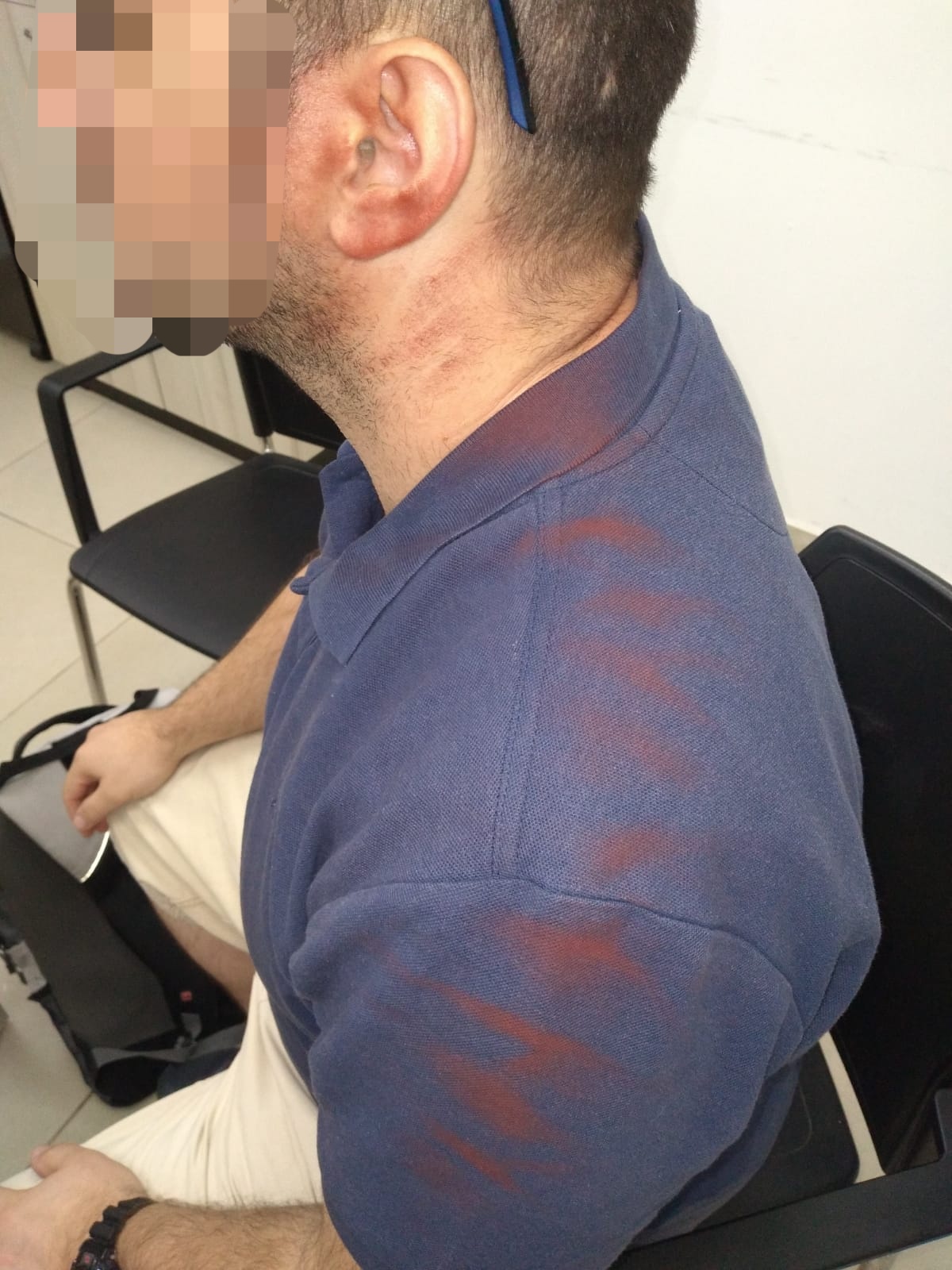 ריססו יהודי בצבע רעיל באמצע נסיעה ברכבת