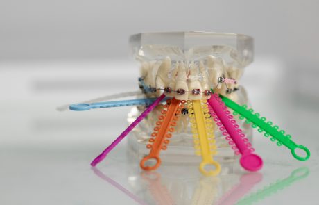 איך לשמור על חיוך אסתטי ובריא גם בשגרה עמוסה