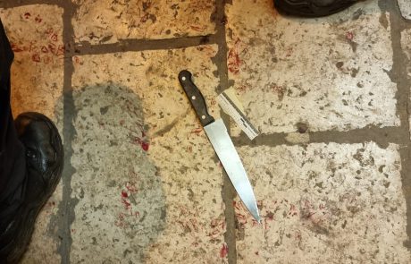 פיגוע דקירה: שני שוטרים נפצעו באורח קל